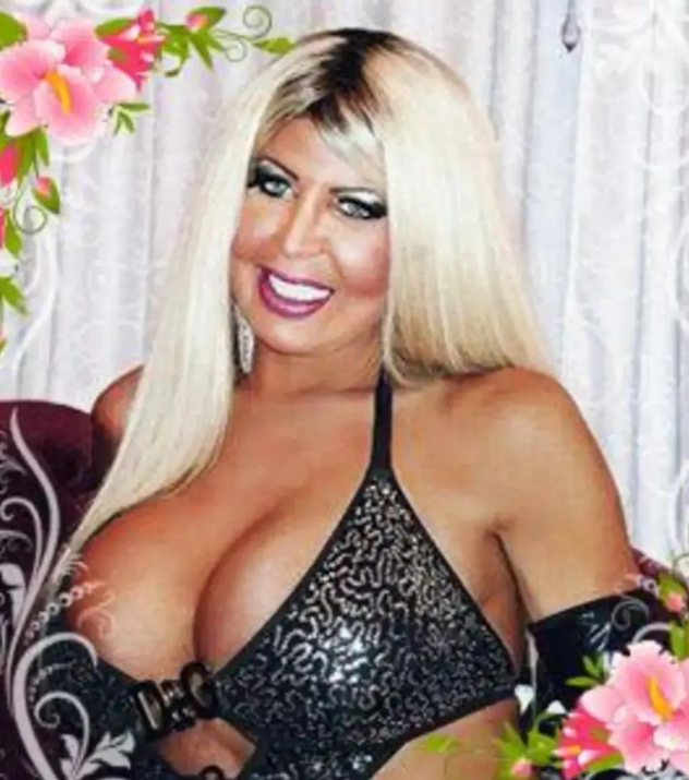 Mulher morre durante cirurgia plástica