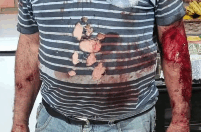 Morador de Maquiné foi atacado enquanto lidava com seus animais.