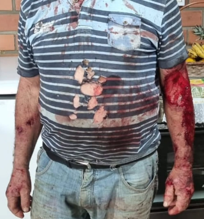 Agricultor fica ferido após ser atacado por animal