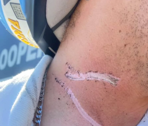 Fio solto causa acidente no Bosques do Albatroz